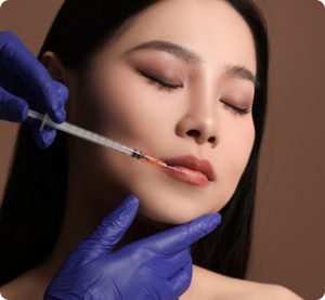Lip Fillers