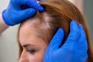 Featured Hair-Treatment Products