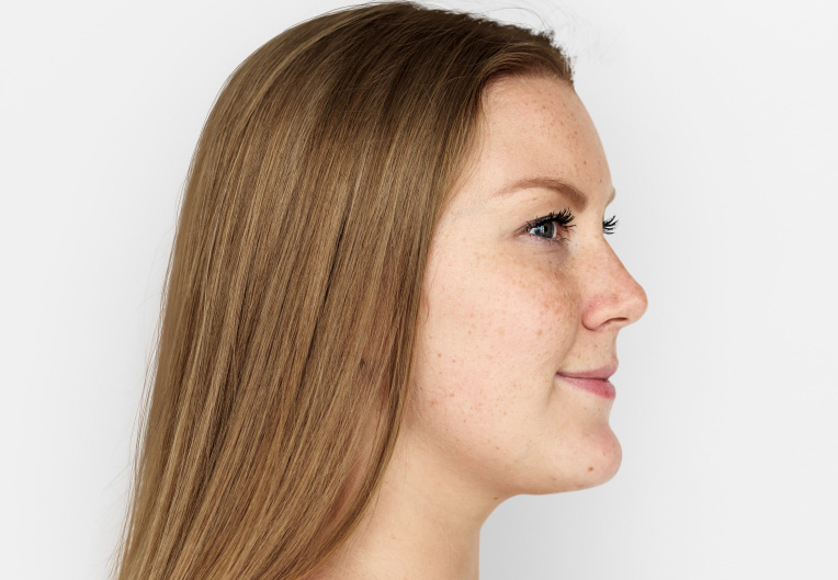 Double-Chins Modal showing Fat Dissolvers