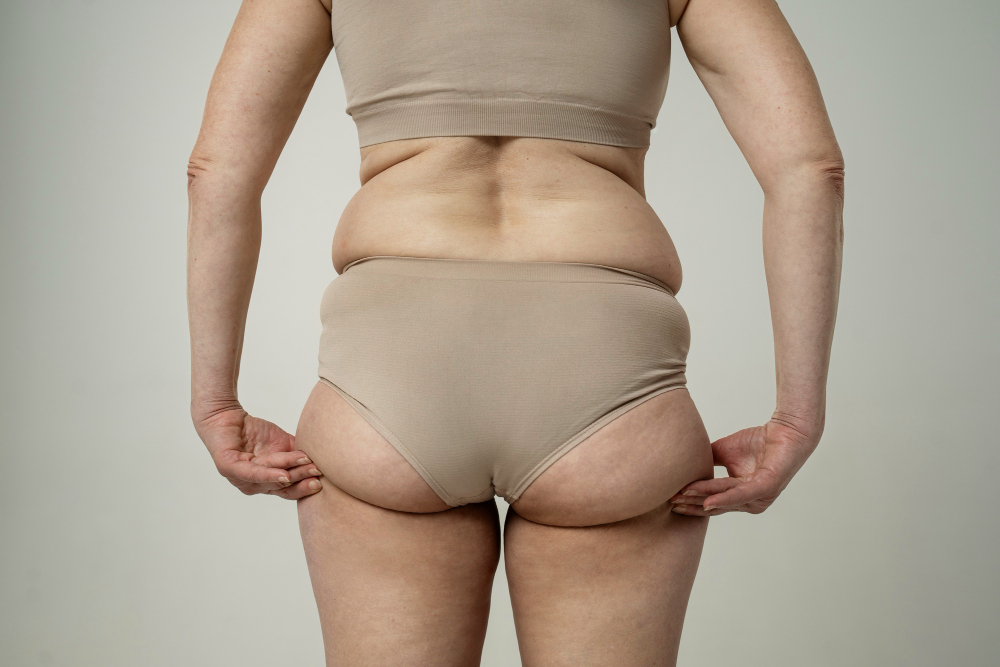 fat-dissolvers-04 Widely Used Fat-Dissolving Solutions in Aesthetic Practice